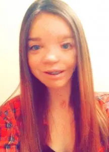 Goldenhar Syndrome Treatment Before and After Pictures Dallas, TX